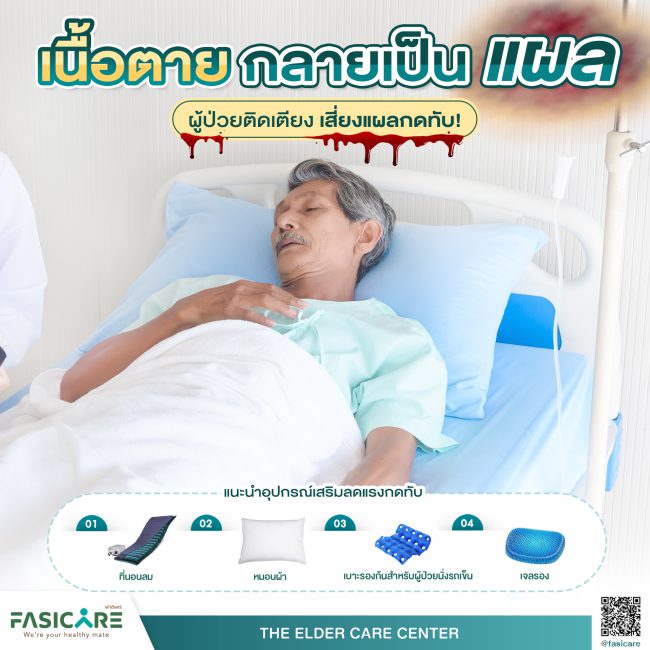 เตียงผู้ป่วย แผลกดทับ