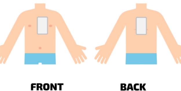 ขั้นตอนการใช้งานเครื่อง AED สำหรับเด็ก